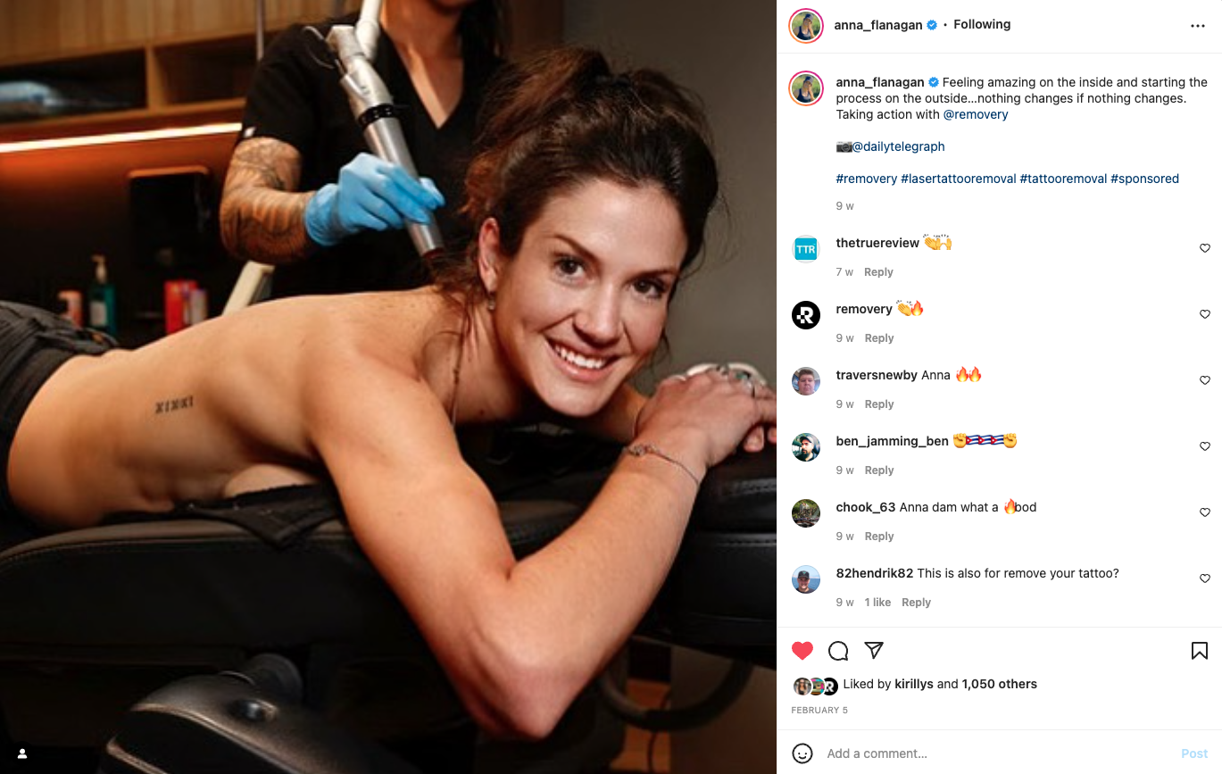 social media post image of Anna Flanagan lying on her front side with a person standing behind her holding a tattoo removal tool, featuring post with comments